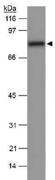 Anti-SR-BI antibody used in Western Blot (WB). GTX20003