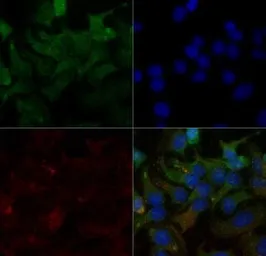 Anti-SR-BI antibody used in Immunocytochemistry/ Immunofluorescence (ICC/IF). GTX20003