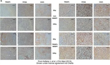 Anti-PCNA antibody [PC10] used in IHC (Paraffin sections) (IHC-P). GTX20029