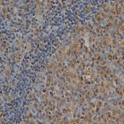 Anti-Ubiquitin antibody [1B4-UB] used in IHC (Paraffin sections) (IHC-P). GTX20122