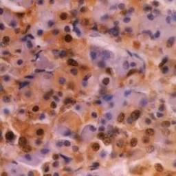 Anti-Ubiquitin antibody [1B4-UB] used in IHC (Paraffin sections) (IHC-P). GTX20122