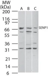 Anti-SENP1 antibody used in Western Blot (WB). GTX20254
