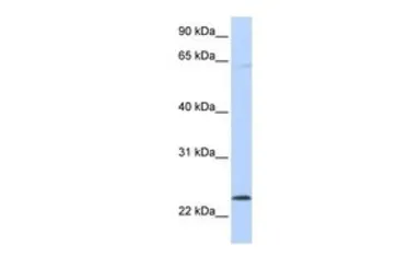Anti-CHAC1 antibody, C-term used in Western Blot (WB). GTX20259