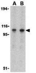 Anti-TLR3 antibody used in Western Blot (WB). GTX20260