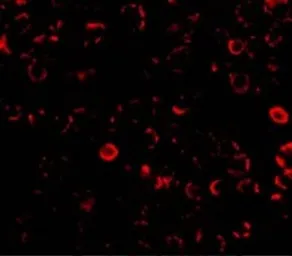 Anti-TLR3 antibody used in Immunocytochemistry/ Immunofluorescence (ICC/IF). GTX20260