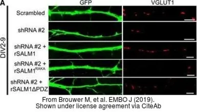 Anti-GFP antibody used in Immunocytochemistry/ Immunofluorescence (ICC/IF). GTX20290