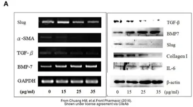 Anti-Collagen I antibody used in Western Blot (WB). GTX20292