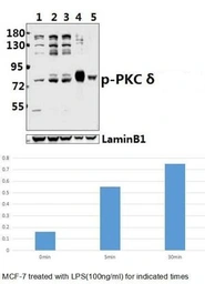 Anti-PKC delta (phospho Thr507) antibody used in Western Blot (WB). GTX20305