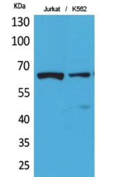 Anti-NFkB p65 (acetyl Lys218) antibody used in IHC (Paraffin sections) (IHC-P). GTX20307