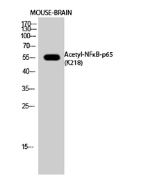 Anti-NFkB p65 (acetyl Lys218) antibody used in Western Blot (WB). GTX20307