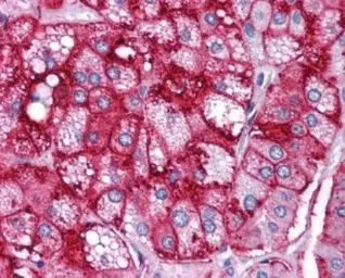 Anti-SR-BI antibody used in IHC (Paraffin sections) (IHC-P). GTX20396