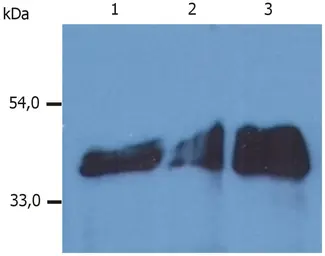 Anti-Cytokeratin 18 antibody [DA-7] used in Western Blot (WB). GTX20669