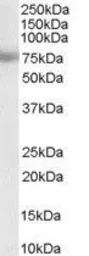 Anti-MTA1 antibody, Internal used in Western Blot (WB). GTX20751