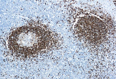 Anti-Hairy Cell Leukemia antibody [DBA.44] used in IHC (Paraffin sections) (IHC-P). GTX20779