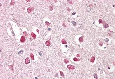 Anti-BAIAP2 (isoform 3) antibody used in IHC (Paraffin sections) (IHC-P). GTX20791