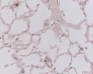 Anti-Ki67 antibody used in Immunohistochemistry (IHC). GTX20833