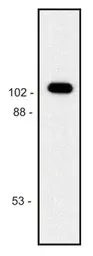 Anti-beta Galactosidase antibody [BG-02] used in Western Blot (WB). GTX21047