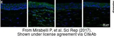 Anti-VEGFA antibody [VG1] used in IHC (Paraffin sections) (IHC-P). GTX21316