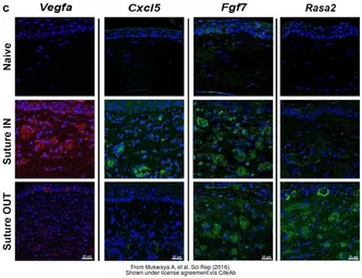 Anti-VEGFA antibody [VG1] used in IHC (Paraffin sections) (IHC-P). GTX21316