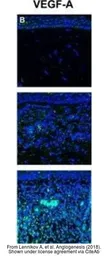 Anti-VEGFA antibody [VG1] used in IHC (Paraffin sections) (IHC-P). GTX21316