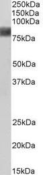 Anti-Cortactin antibody, N-term used in Western Blot (WB). GTX21374