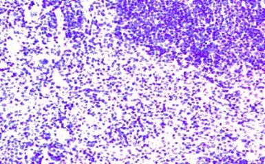 Anti-CCR7 antibody used in IHC (Paraffin sections) (IHC-P). GTX21657