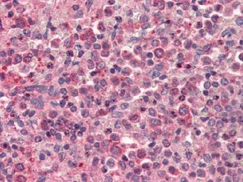 Anti-CXCR4 antibody used in Immunohistochemistry (IHC). GTX21670
