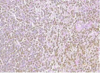Anti-CXCR4 antibody used in IHC (Paraffin sections) (IHC-P). GTX21671