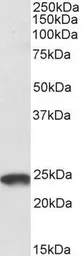 Anti-TMS1 antibody, C-term used in Western Blot (WB). GTX22236