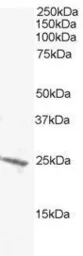 Anti-BAK antibody used in Western Blot (WB). GTX22273