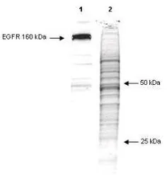 Anti-Phosphotyrosine antibody [13F9] used in Western Blot (WB). GTX22287