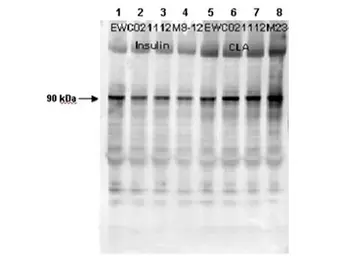 Anti-Glycogen synthase 1 (phospho Ser641) antibody used in Western Blot (WB). GTX22479