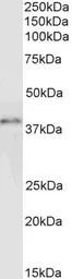 Anti-GRAP2 antibody used in Western Blot (WB). GTX22520