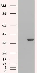 Anti-GRAP2 antibody used in Western Blot (WB). GTX22520