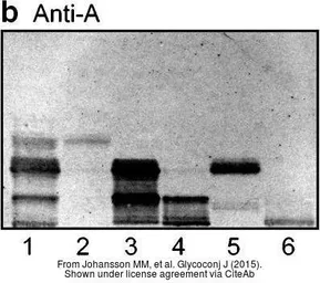 Anti-Blood Group A antigen antibody [HE-193] used in Thin layer chromatoqraphy (TLC). GTX22521