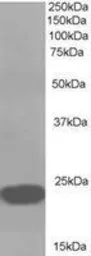 Anti-RKIP antibody, C-term used in Western Blot (WB). GTX22634