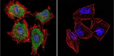 Anti-Cytohesin 1 antibody [2E11] used in Immunocytochemistry/ Immunofluorescence (ICC/IF). GTX22727