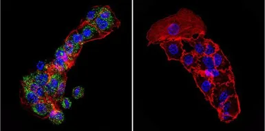 Anti-Cytohesin 1 antibody [2E11] used in Immunocytochemistry/ Immunofluorescence (ICC/IF). GTX22727