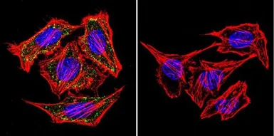 Anti-alpha Adaptin antibody [AP6] used in Immunocytochemistry/ Immunofluorescence (ICC/IF). GTX22730