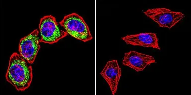 Anti-Clathrin Heavy chain antibody [X22] used in Immunocytochemistry/ Immunofluorescence (ICC/IF). GTX22731