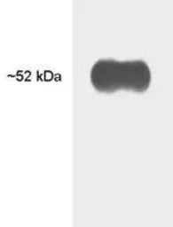 Anti-Thyroid Hormone Receptor beta antibody [J52] used in Western Blot (WB). GTX22744