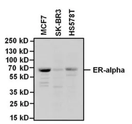 Anti-Estrogen Receptor alpha antibody [33] used in Western Blot (WB). GTX22746