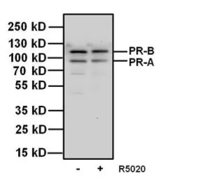 Anti-Progesterone Receptor antibody [Alpha PR6] used in Western Blot (WB). GTX22765