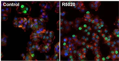 Anti-Progesterone Receptor antibody [Alpha PR6] used in Immunocytochemistry/ Immunofluorescence (ICC/IF). GTX22765