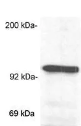 Anti-Glucocorticoid Receptor antibody [BuGR2] used in Western Blot (WB). GTX22768
