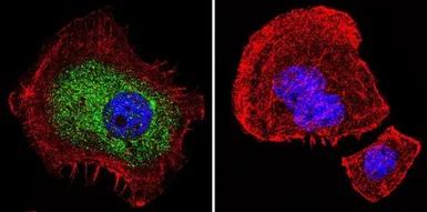 Anti-Glucocorticoid Receptor antibody [BuGR2] used in Immunocytochemistry/ Immunofluorescence (ICC/IF). GTX22768