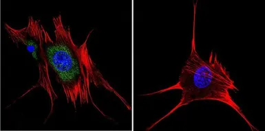 Anti-AHR antibody [RPT1] used in Immunocytochemistry/ Immunofluorescence (ICC/IF). GTX22770
