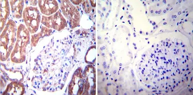 Anti-Mineralocorticoid Receptor antibody [H10E4C9F] used in IHC (Paraffin sections) (IHC-P). GTX22774
