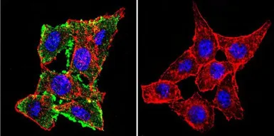 Anti-CFTR antibody [CF3] used in Immunocytochemistry/ Immunofluorescence (ICC/IF). GTX22784