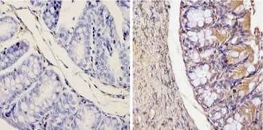 Anti-Galectin 3 antibody [A3A12] used in IHC (Paraffin sections) (IHC-P). GTX22785